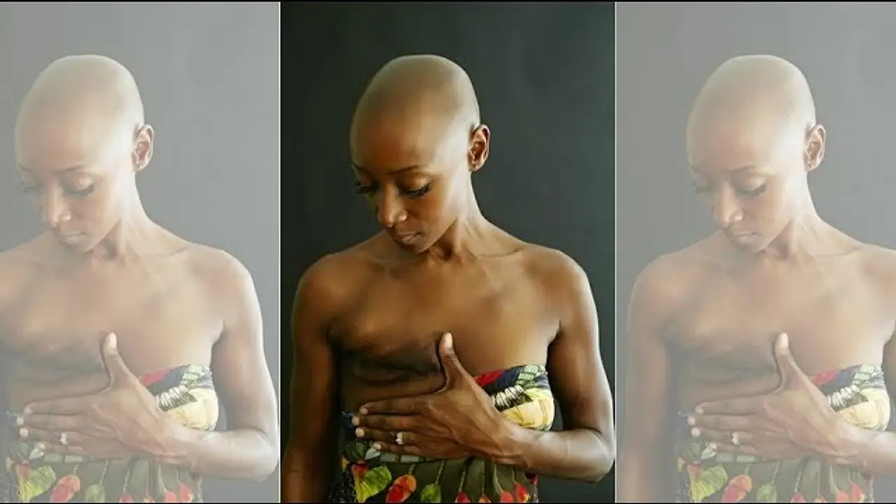 A NOUS LA TÉLÉ DIT TOUT SUR LE CANCER DU SEIN