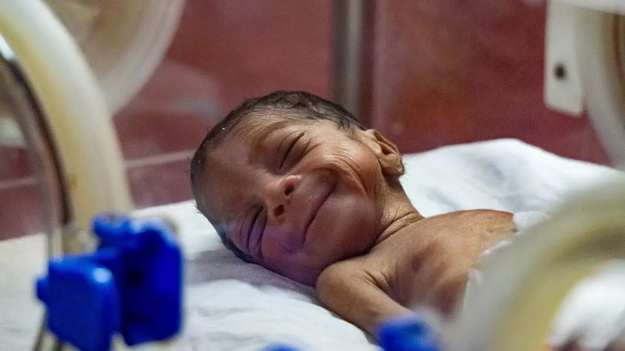 BON APPÉTIT DIT TOUT SUR LES ENFANTS PRÉMATURÉS